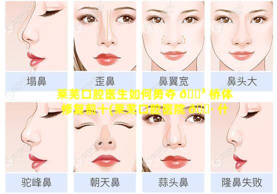 莱芜口腔医生如何勇夺 🐳 桥体修复前十(莱芜口腔医院 🕷 什么时候营业)